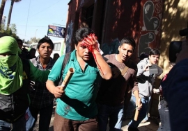 Jhon Copaga es herido por un granada de gas